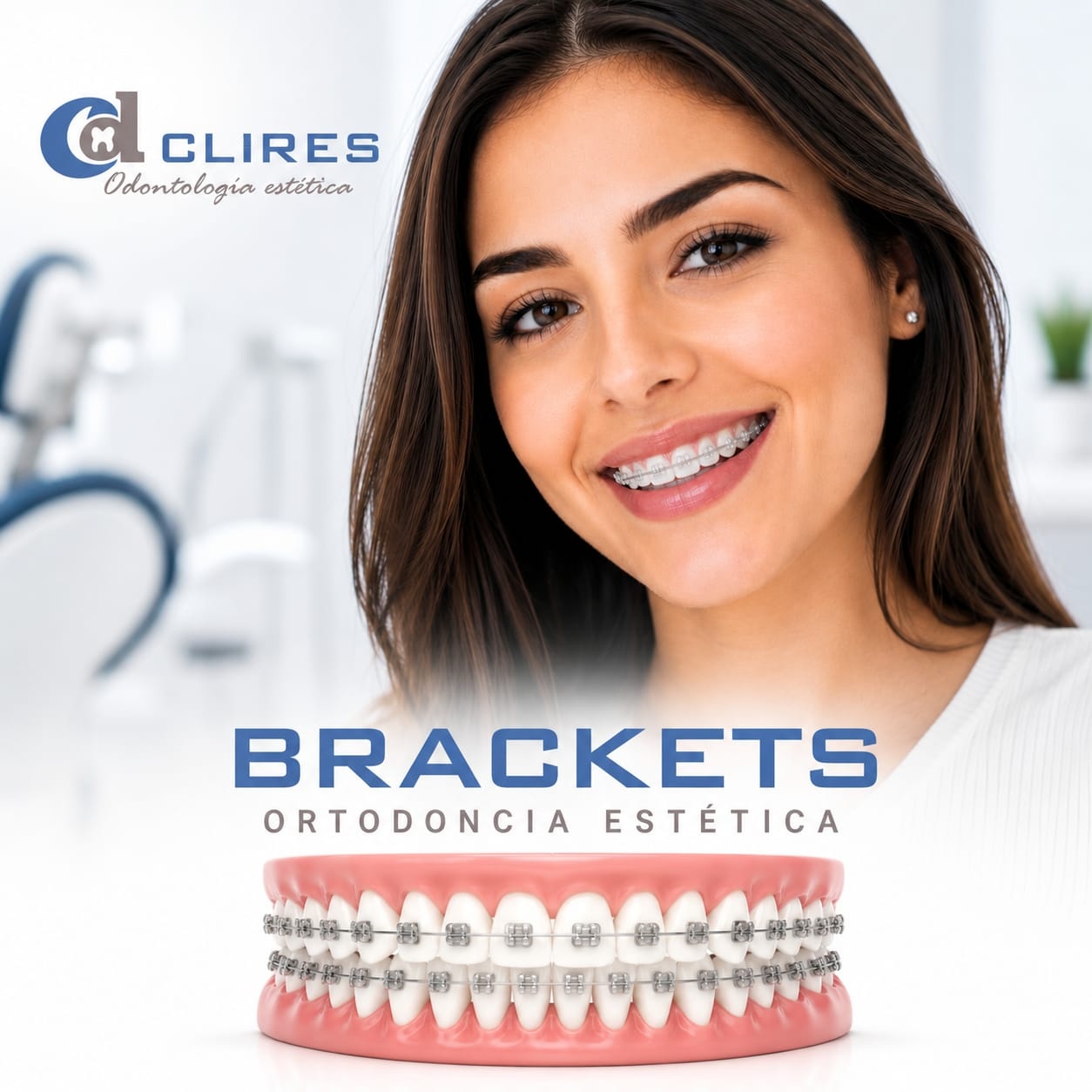 Brackets dentales CLIRES